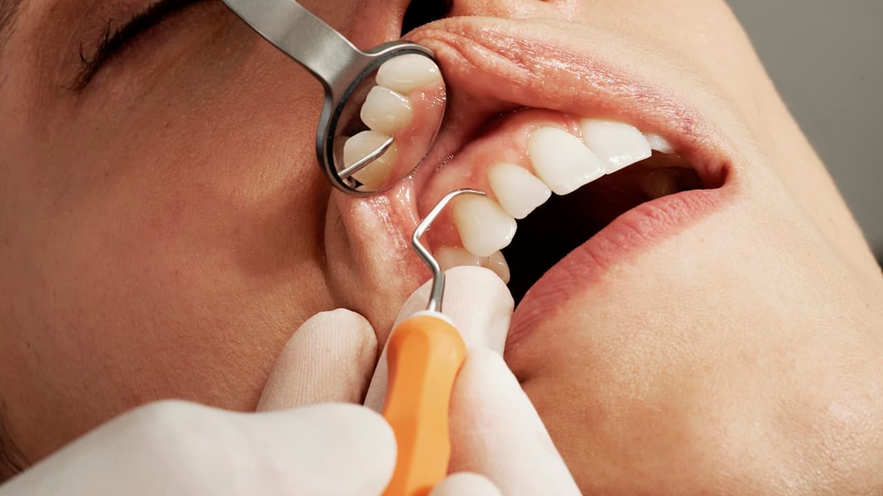 Smile Design in Puerto Vallarta: What to Expect and Real Costs